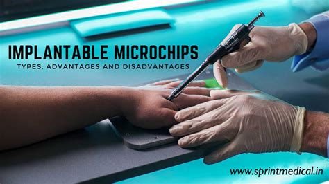 advantages of rfid chips in humans|Human Microchipping: The Benefits and Disadvantages .